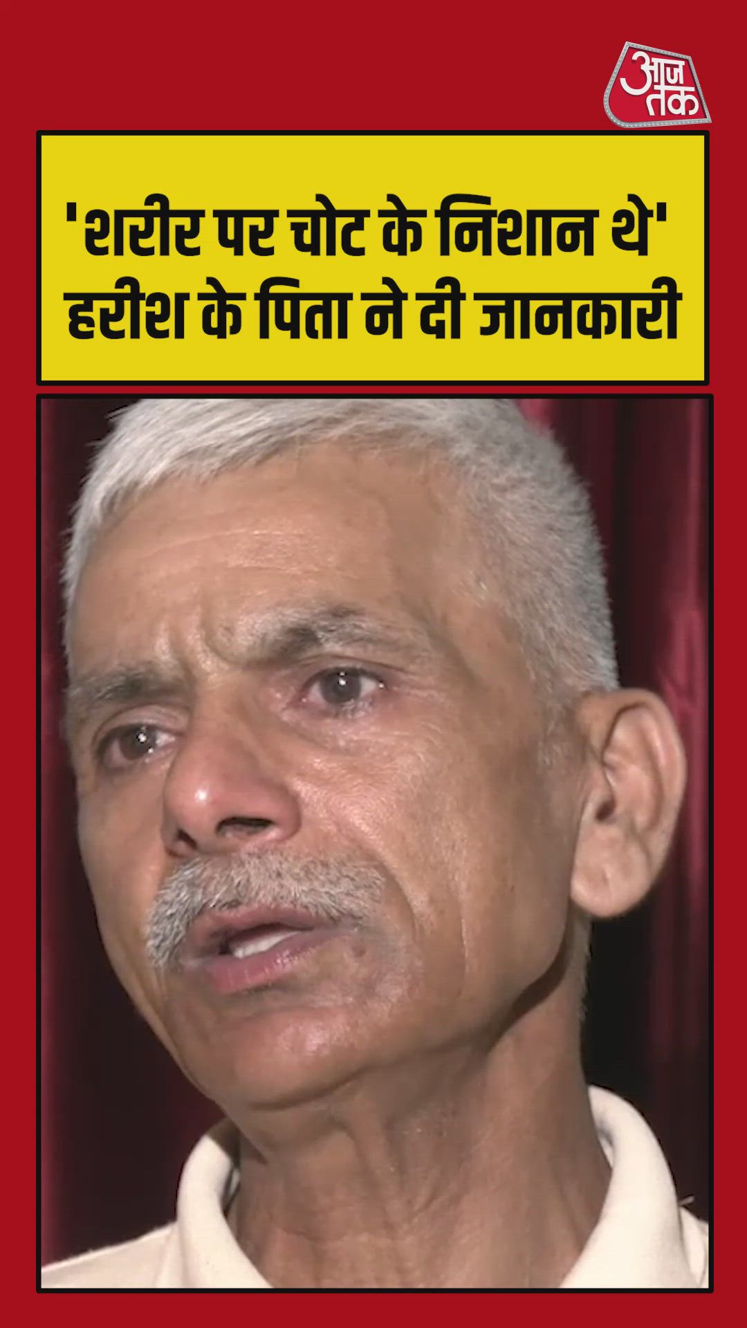 finger marks and bruises observed after ct scans