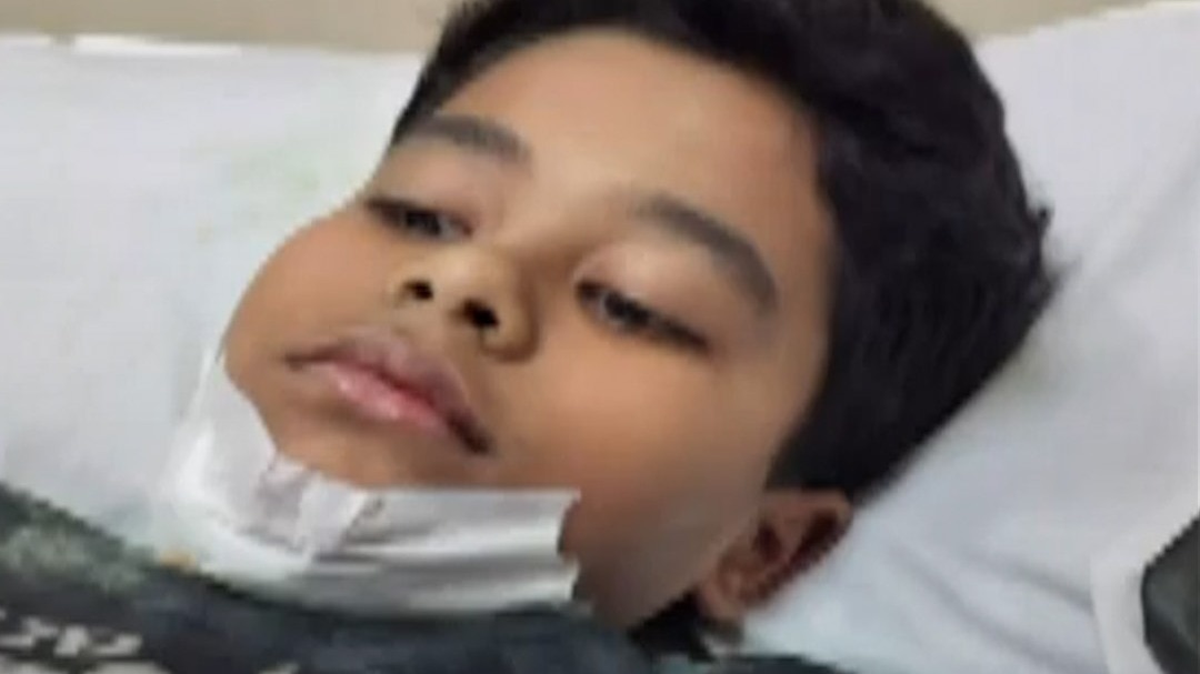 खेलते समय बच्चे के मुंह में घुसा लोहे का नुकीला सरिया