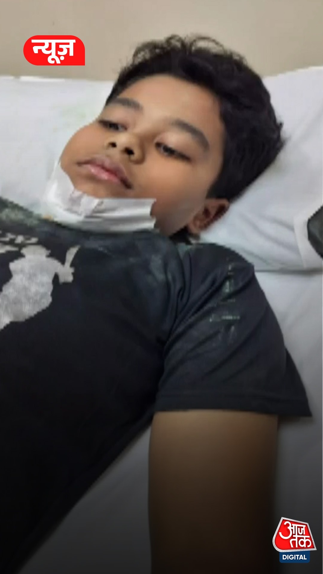 खेलते समय बच्चे के मुंह में घुसा लोहे का नुकीला सरिया