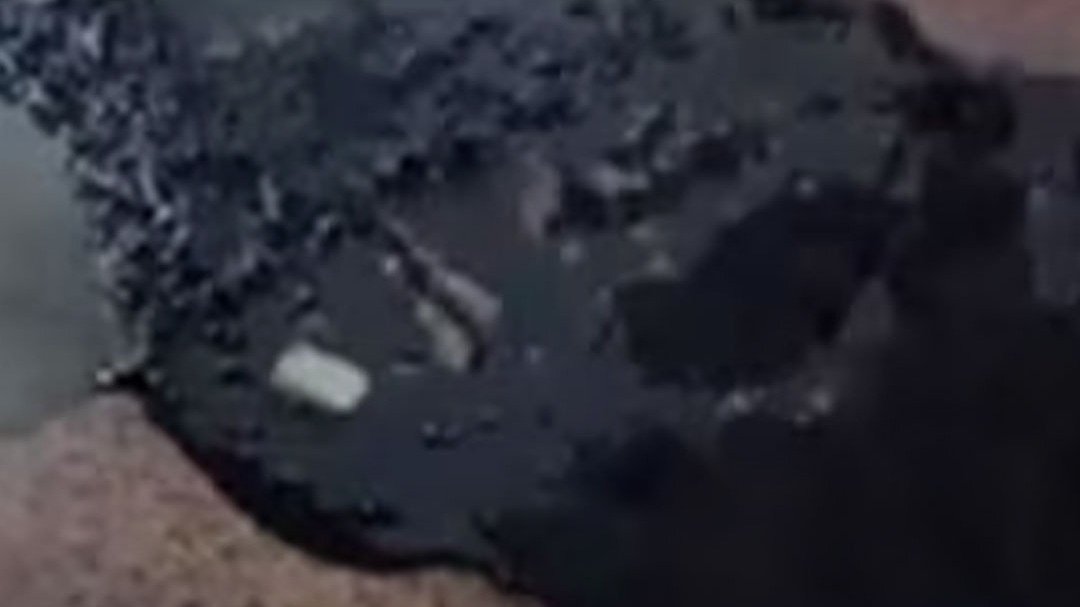 gurugram women attacked with chemical in hospital