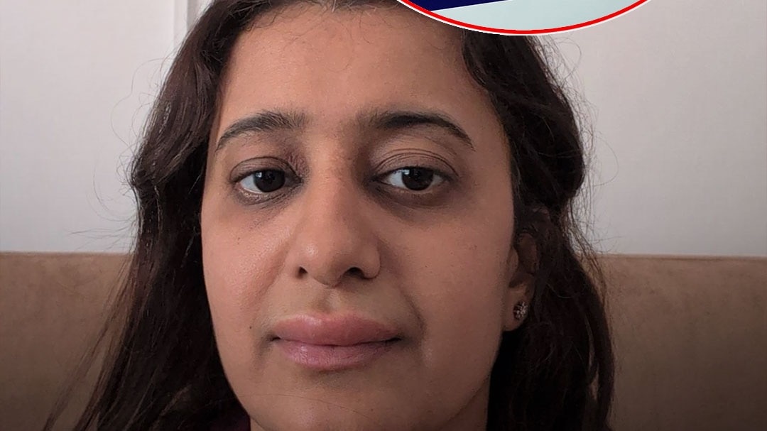 ट्रेन के खाने से एलर्जी, उठे सवाल