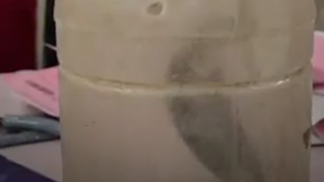 महिला संग जिंदा नाग पहुंचा वार्ड, Video