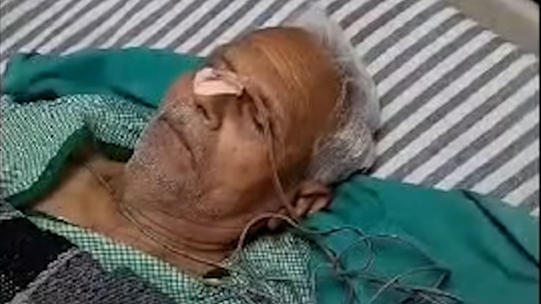 डॉक्टरों की लापरवाही, ऑपरेशन अधूरा छोड़ लगाए टांके