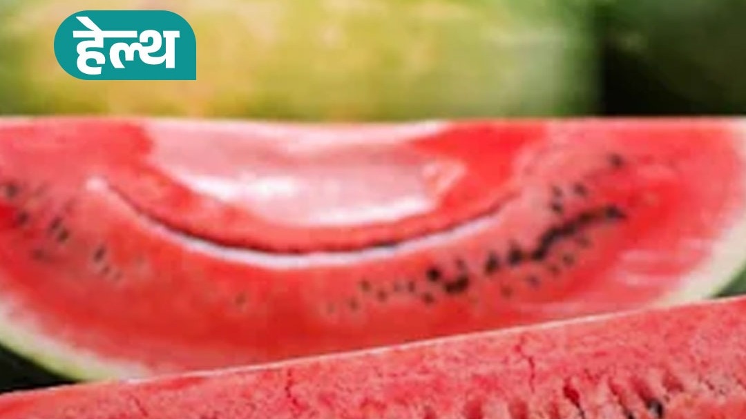 तरबूज़ से खतरा? डॉक्टर की चेतावनी, रखें ये सावधानी