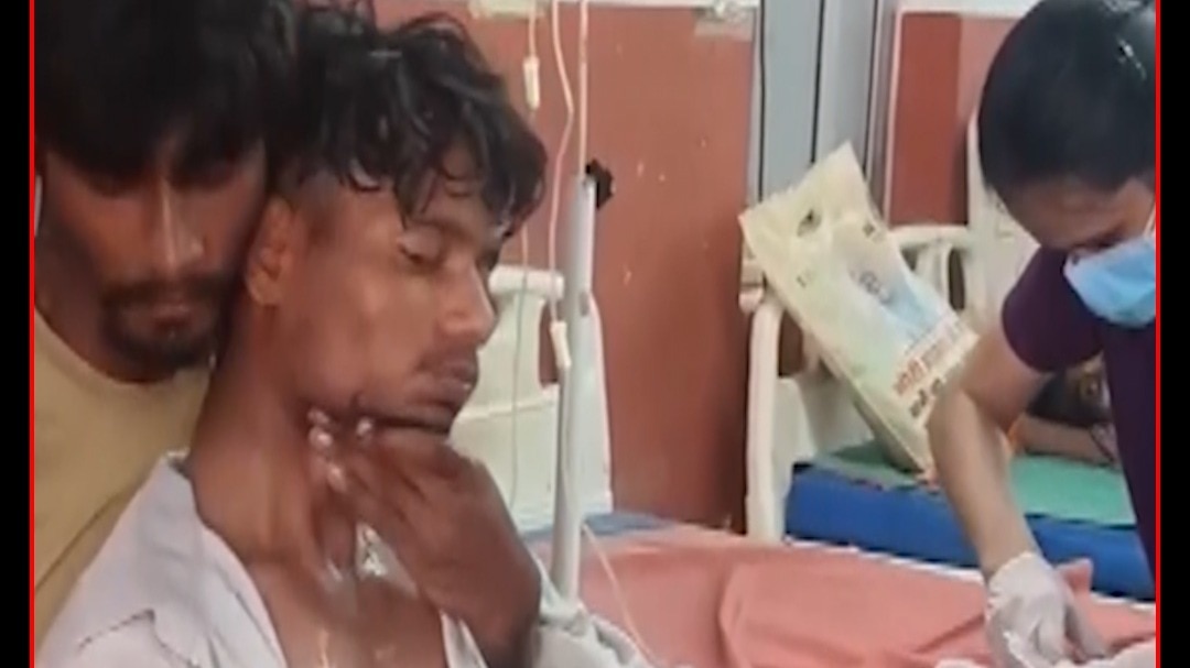 hardoi snake bite youth 