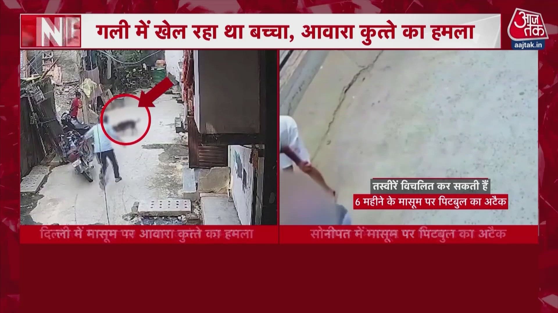 Stray dog attacks 18 month old toddler in Delhi Timarpur.