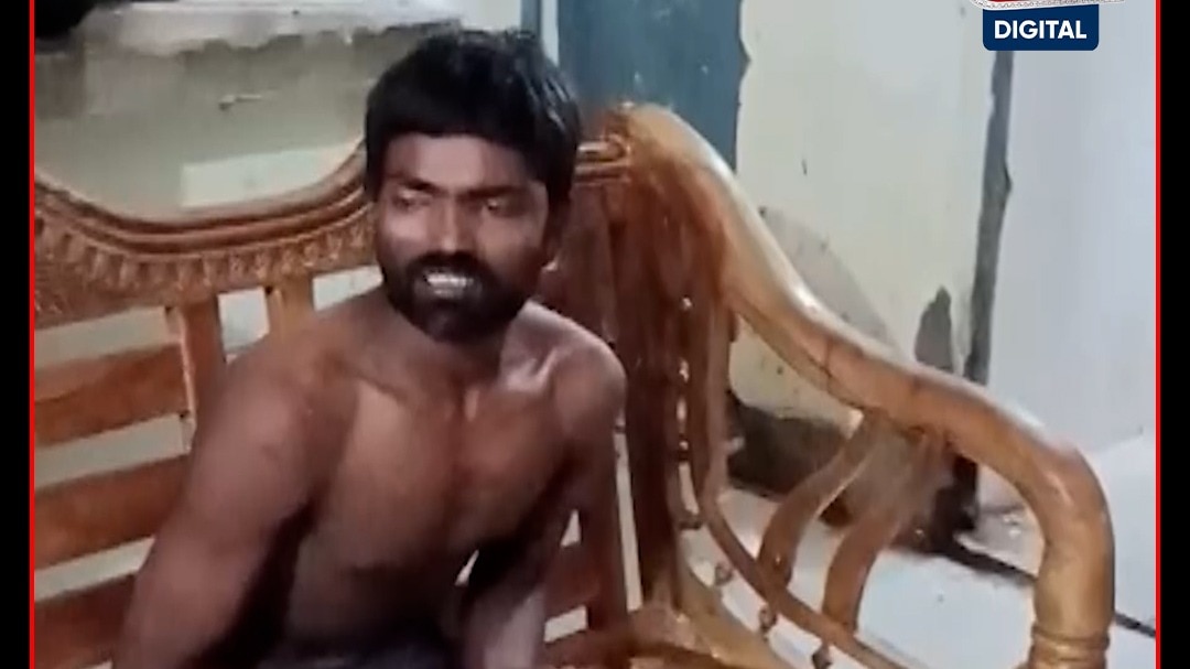 Son Burnt Mother