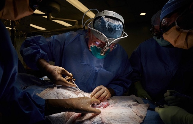 organ transplant from non human to human amid pig kidney transplant case photo AFP organ transplant from non human to human amid pig kidney transplant case photo AFP