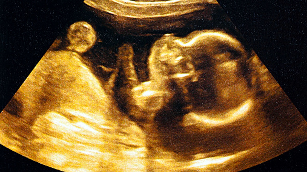 Pollution in Mothers Womb