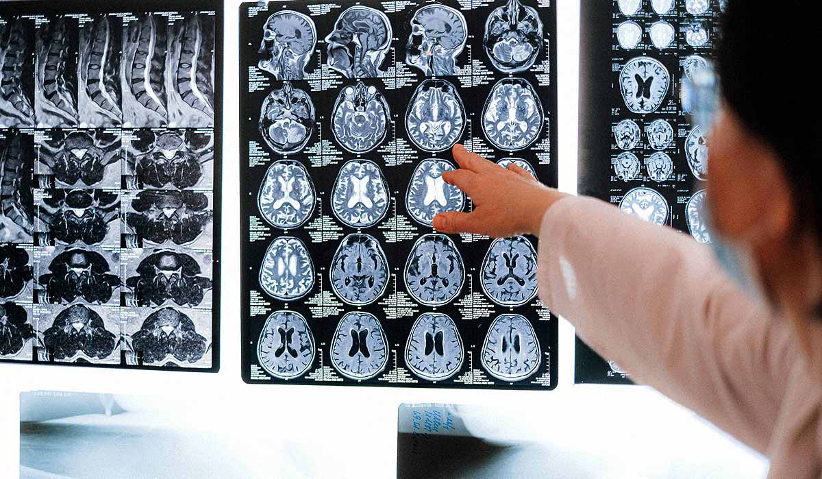     alegria de depressão