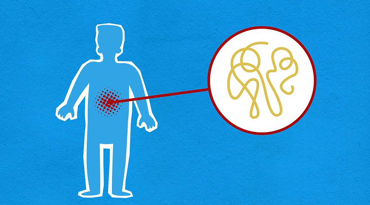  ebola outbreak Congo