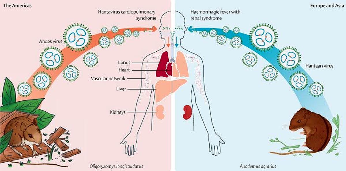 Hantavirus Outbreak