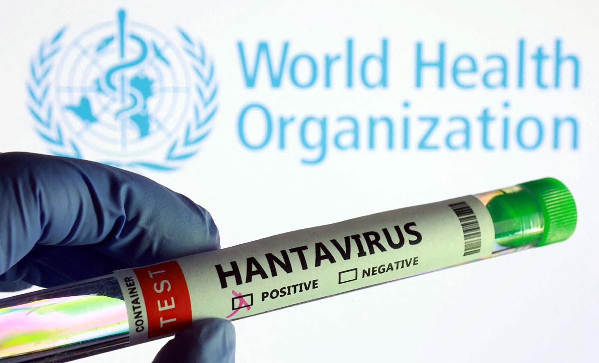 Hantavirus sexual transmission Sperm
