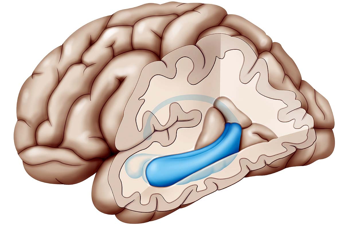 पूर्ण मौन मस्तिष्क