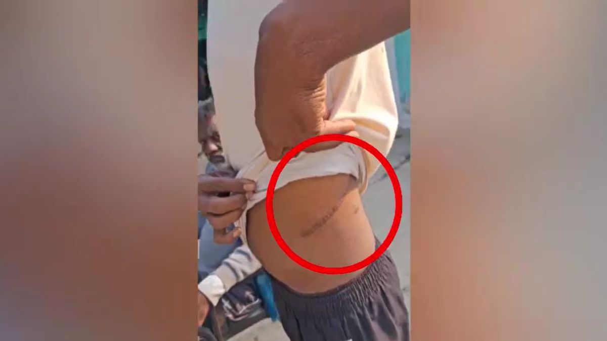 Medical Kolkata surgery in Cambodia Maharashtra farmer sell kidney