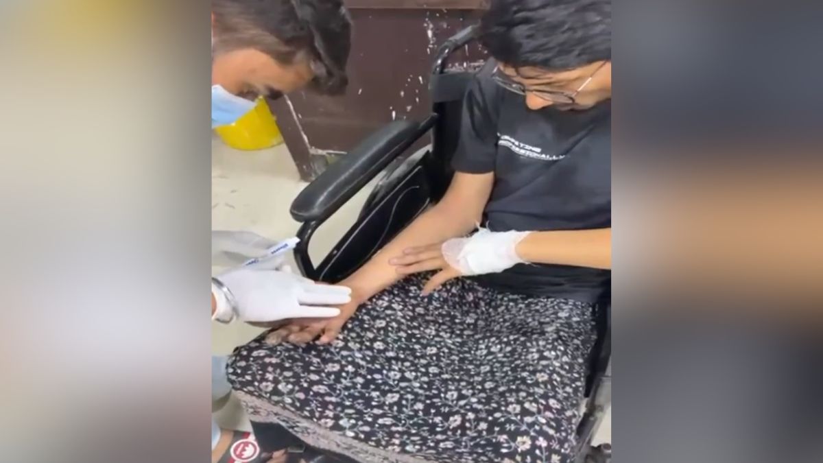 mobile phone explodes in pocket ghaziabad railway station man injured mobile phone explodes in pocket ghaziabad railway station man injured