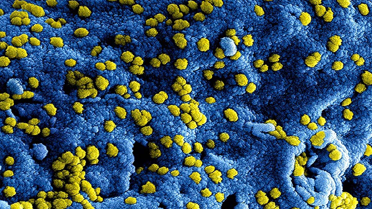 one lab accident activated two virus one lab accident activated two virus