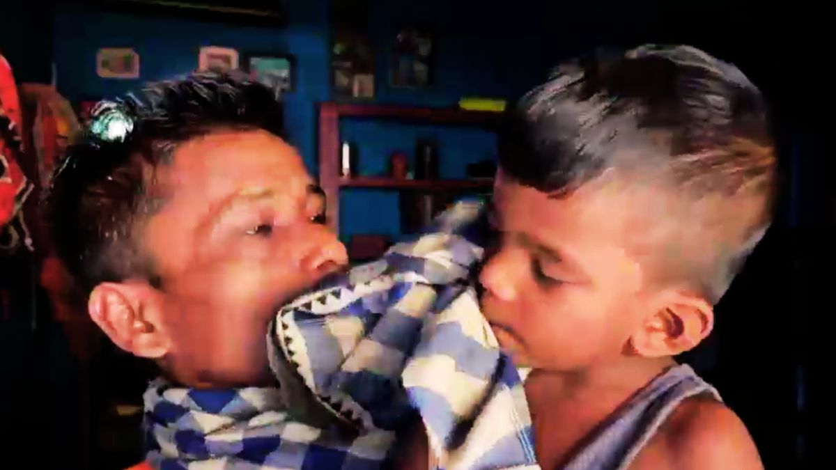 odisha 3 year old boy swallows iron nail stuck stomach 28 days