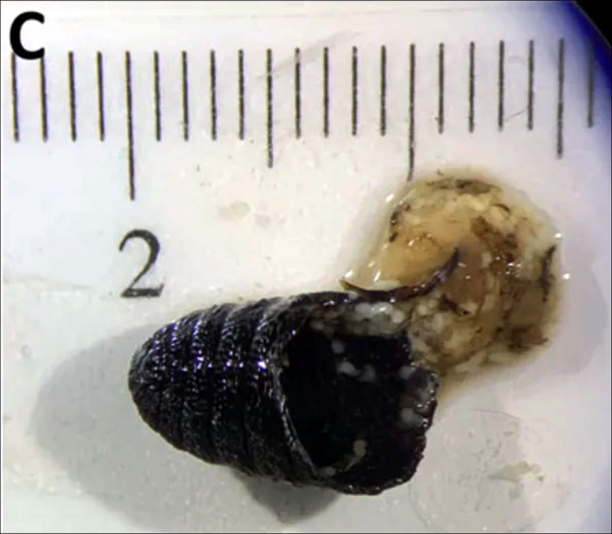 sheep fly in woman nose