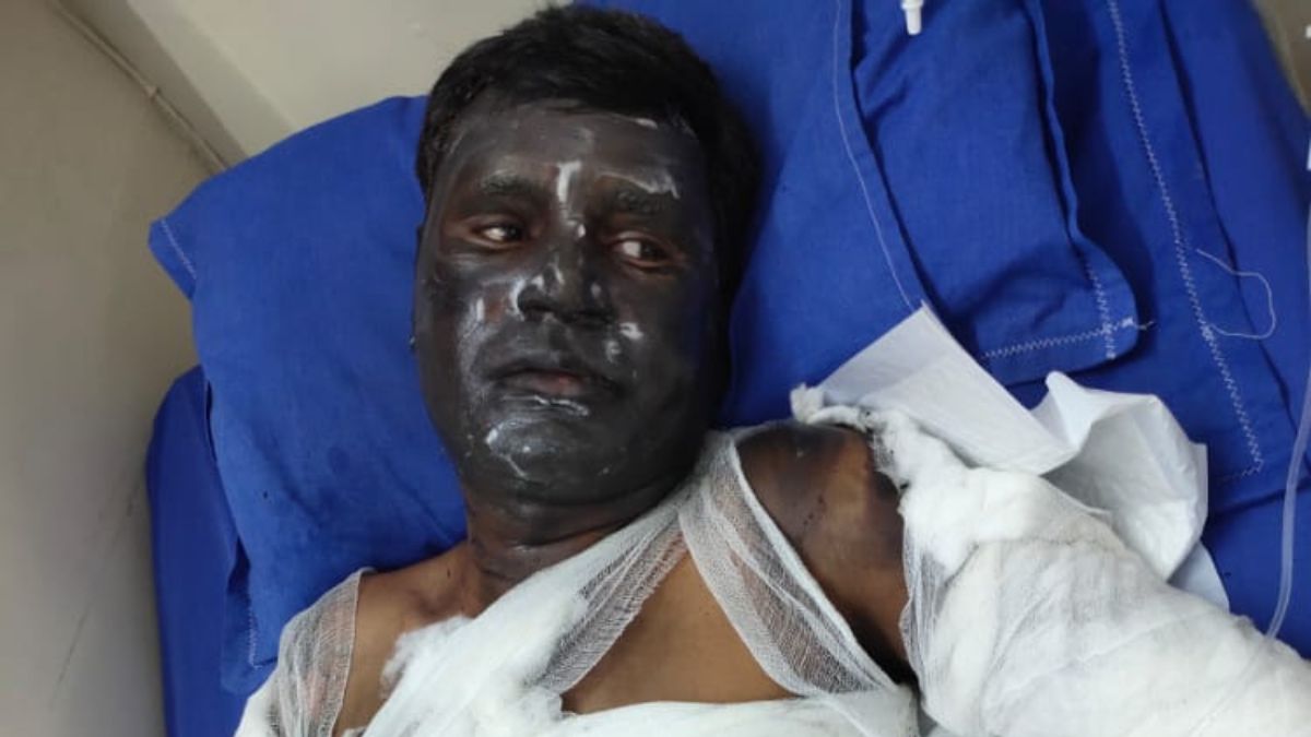 भोपाल के बिजली सब स्टेशन में जोरदार धमाका, फॉल्ट सुधार रहा इंजीनियर झुलसा, दिल दहला देगा VIDEO