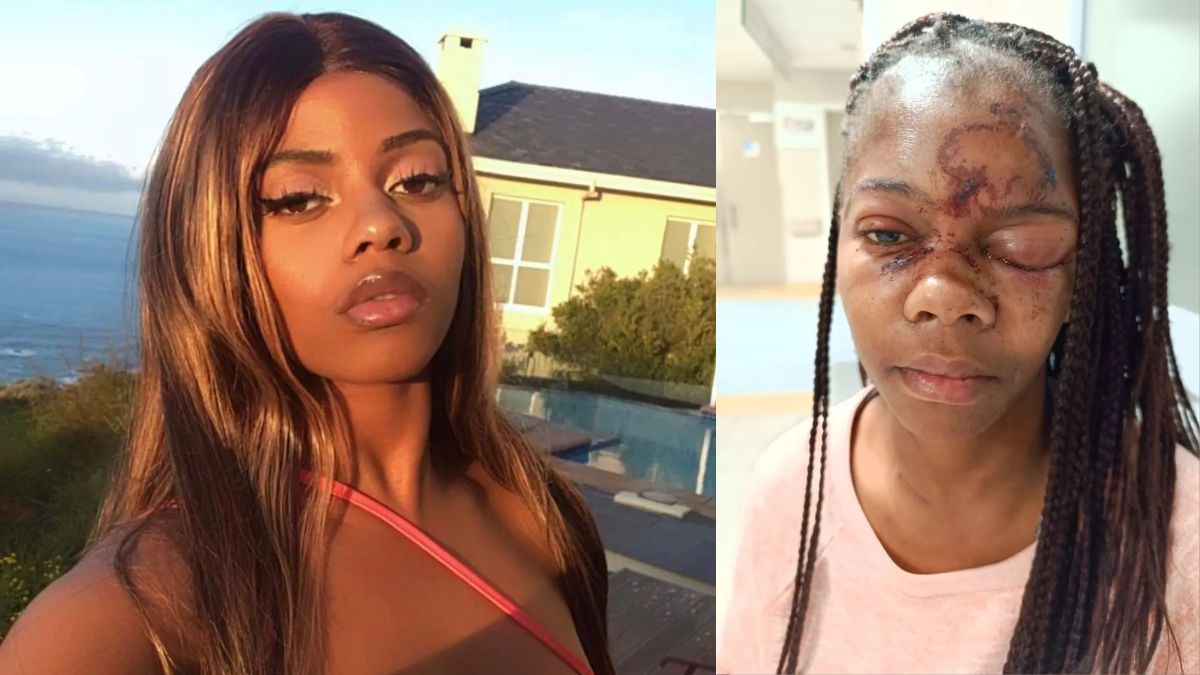 छेड़छाड़ का विरोध करने पर लड़की पर हमला (तस्वीर- Kennedy News/Nikita Kalubi)