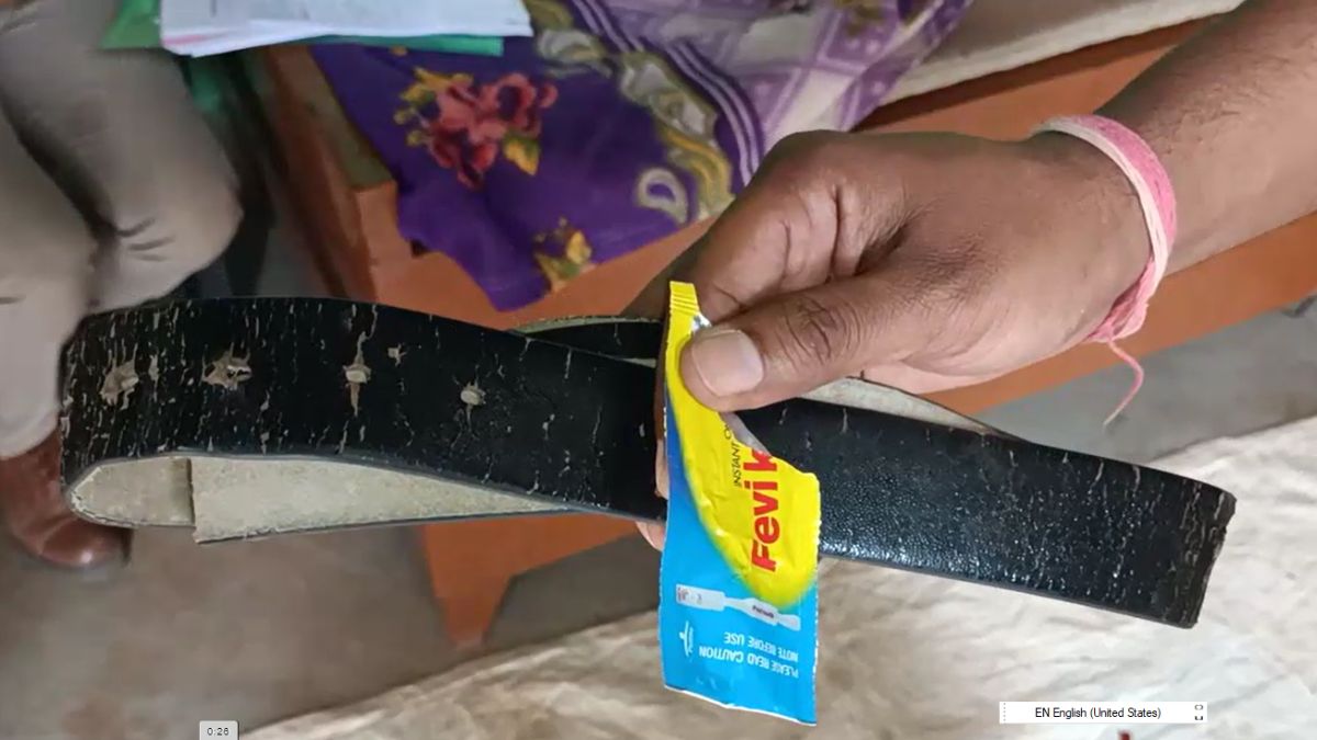 Guna Feviquick brutality Guna Feviquick brutality