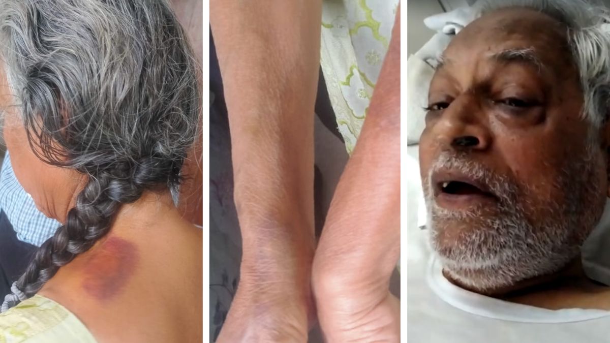 पीड़ित बुजुर्ग दंपती को बेटी ने बेरहमी से पीटा पीड़ित बुजुर्ग दंपती को बेटी ने बेरहमी से पीटा