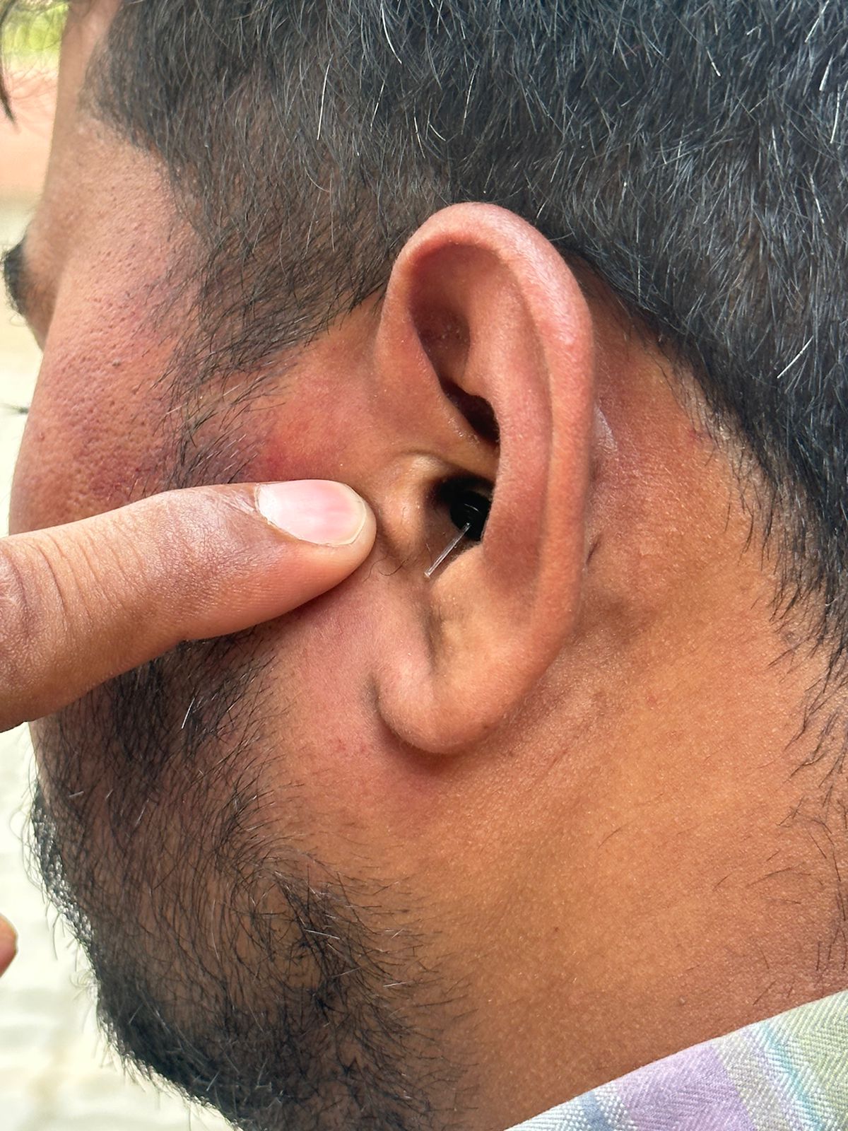 फाइल फोटो