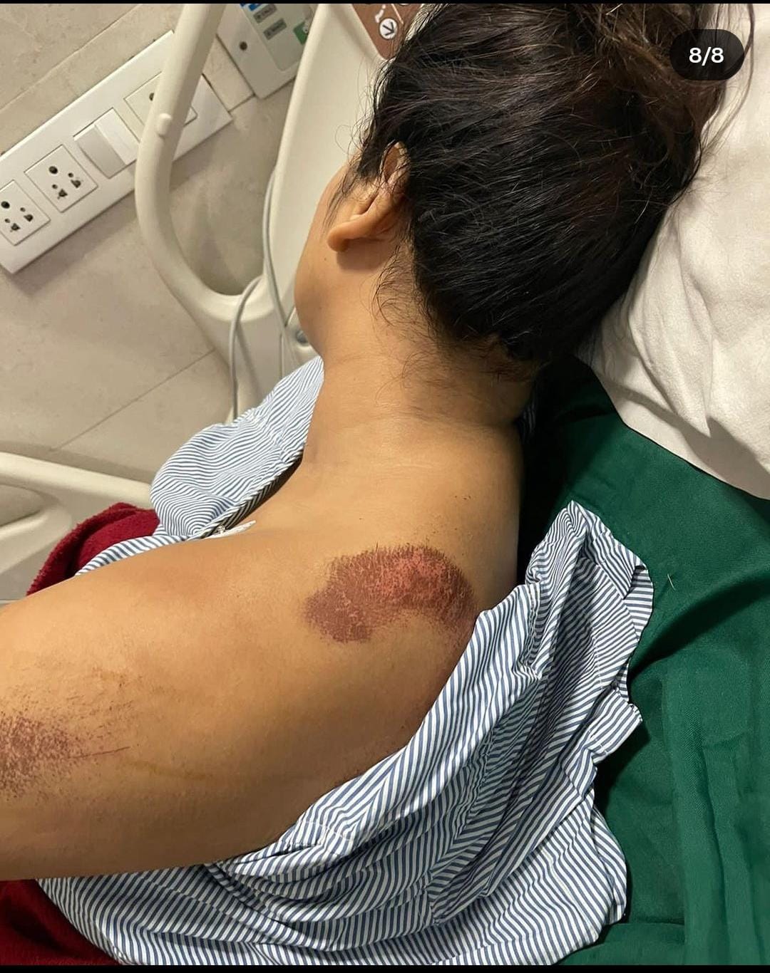 इंस्टाग्राम इंफ्लुएंसर से हैवानियत... आरोपी बॉयफ्रेंड ने पुलिस से कहा- वो मेरी सिर्फ दोस्त थी