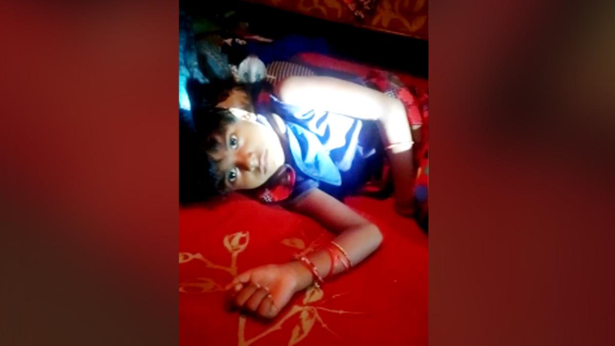 बच्ची के गले में लिपटा सांप.