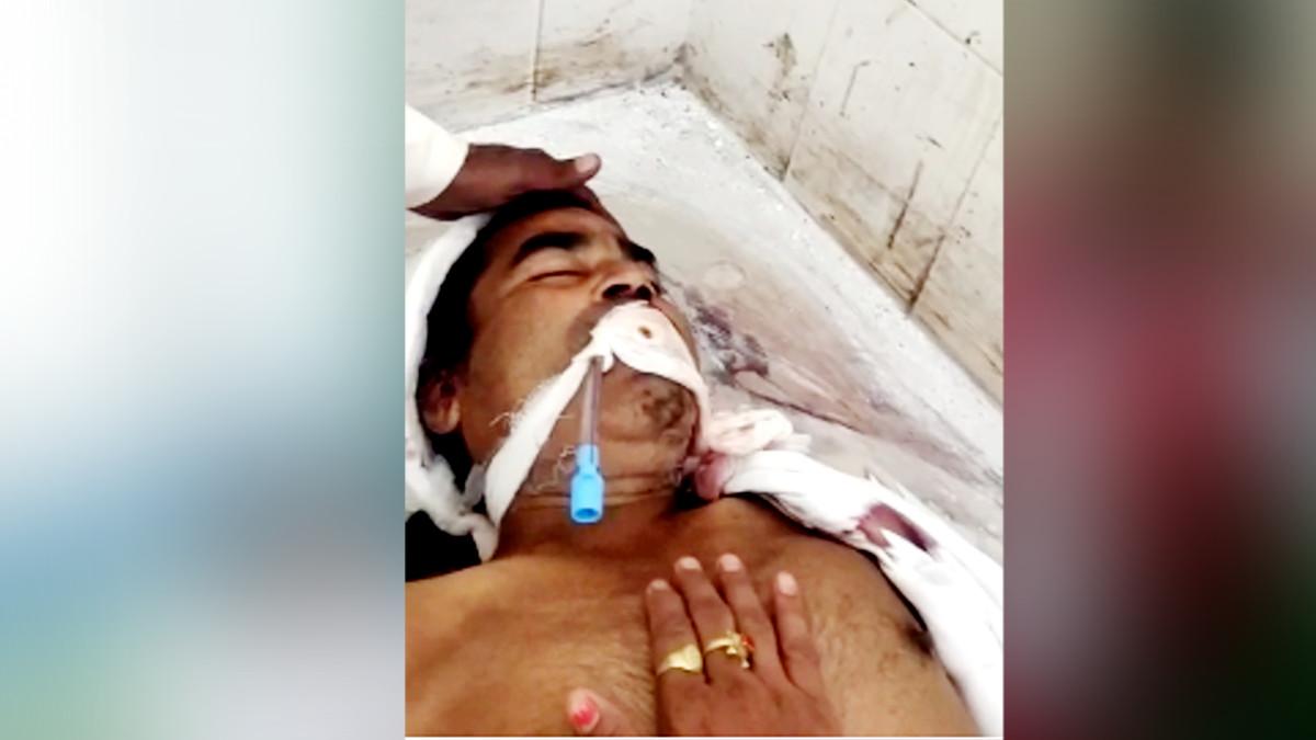 7 घंटे बाद ज‍िंंदा म‍िला शख्स. 