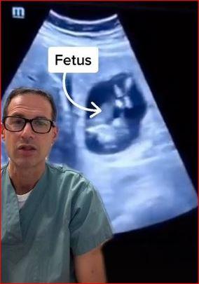 Photo: Tiktok/Michael Narvey