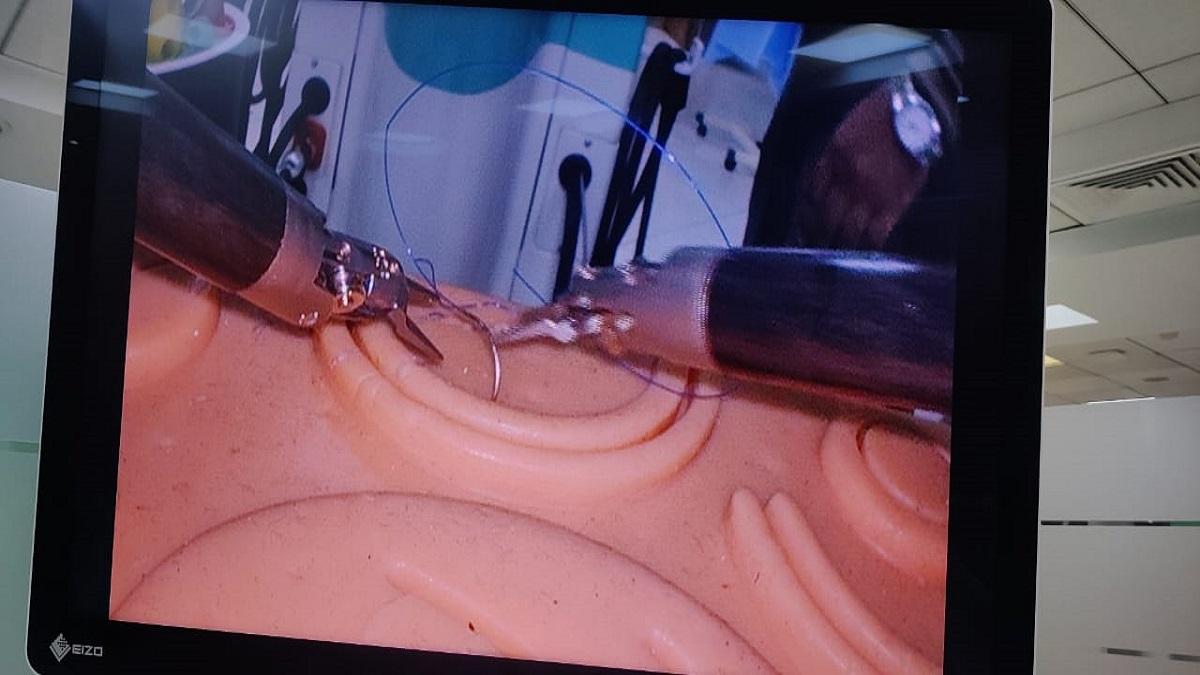 रोबोट द्वारा सर्जरी किए जाने के बाद मरीज 2-3 दिनों में ही ठीक हो जाता है.