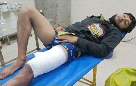 आरोपी फैजल के पैर में लगी गोली.