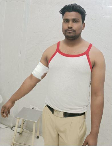 घायल पुलिसकर्मी विक्रम.