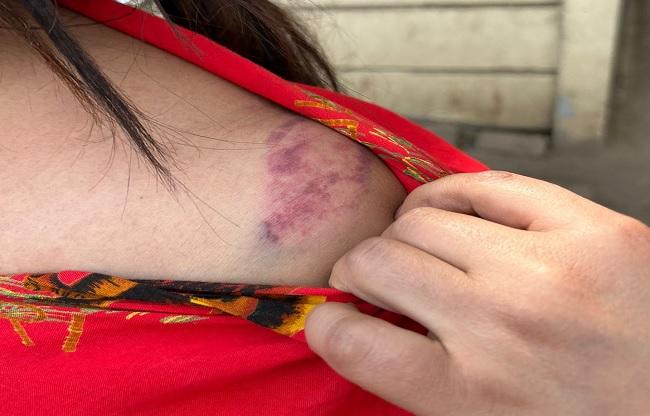 पड़ोसी ने महिला को पीटा.