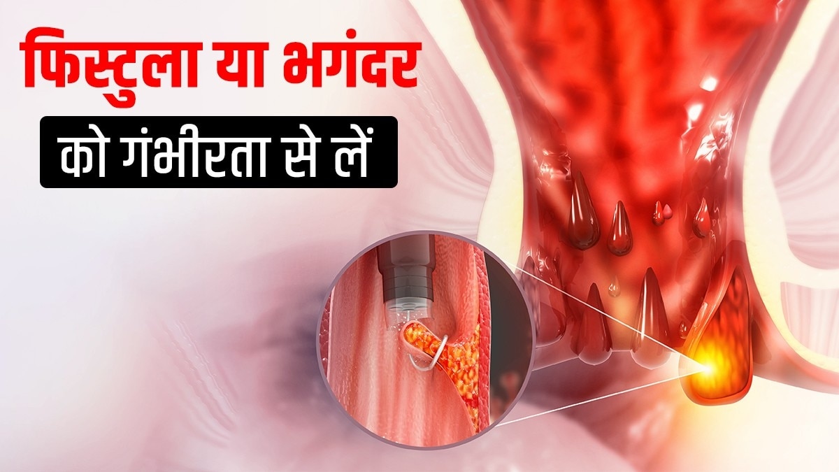 प्रतीकात्मक तस्वीर