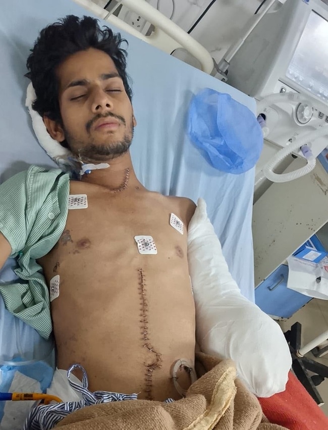 पीड़ित की हुई फूड पाइप सर्जरी, हाथ में फैला इंफेक्शन