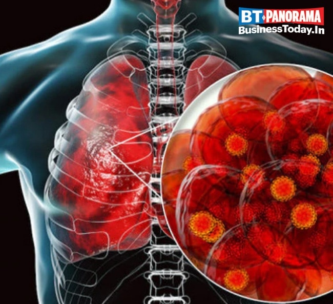 Why is White Fungus more dangerous than Black Fungus