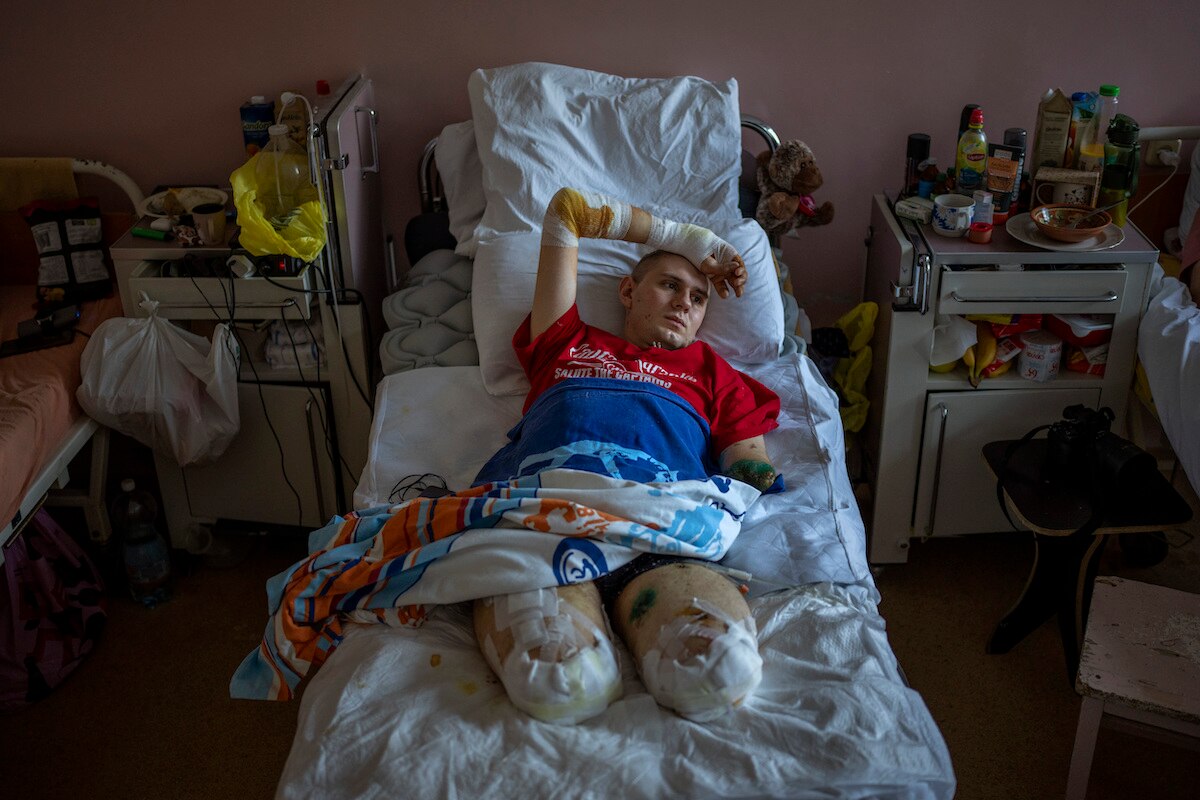 Anton Gladun lies on his bed at the Third City Hospital in Cherkasy, Ukraine.