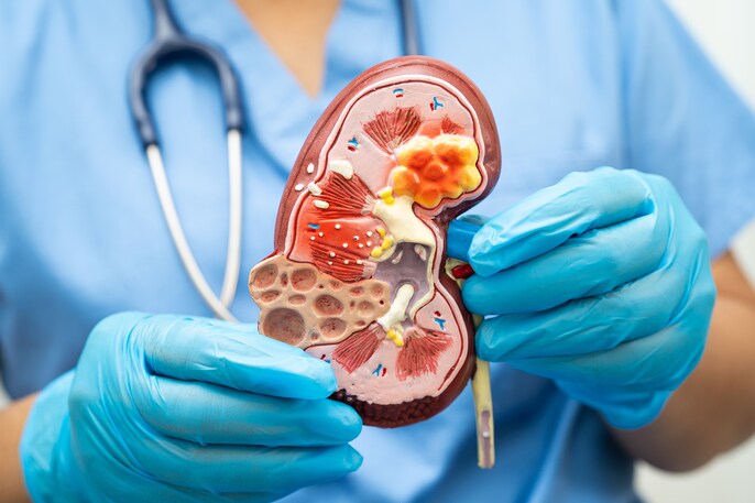 Kidney Guard Kidney Guard