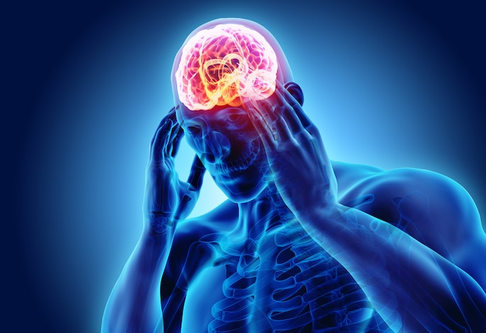 Migraine Mystery Migraine Mystery