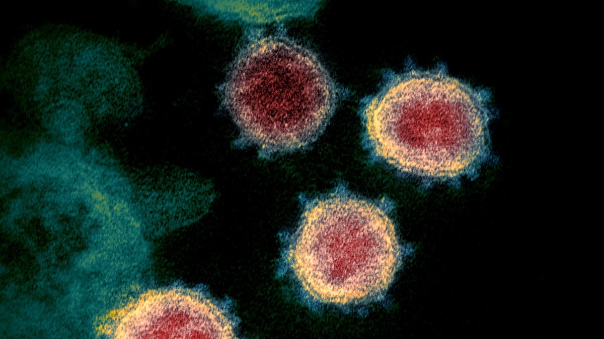 First case of Shamonda virus detected in France: What authorities say about the virus and public risk