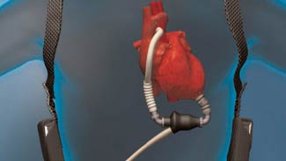 HeartMate II is for patients who are too frail to undergo a heart transplant. HeartMate II is for patients who are too frail to undergo a heart transplant.