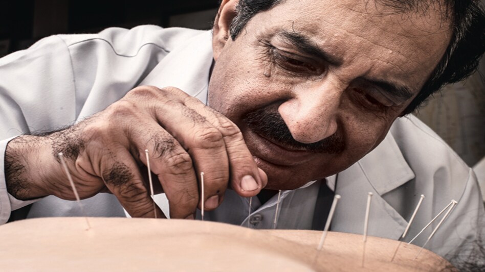 In demand: Delhi-based acupuncture expert Dr Raman Kapur at work. PHOTO: Vivan Mehra In demand: Delhi-based acupuncture expert Dr Raman Kapur at work. PHOTO: Vivan Mehra