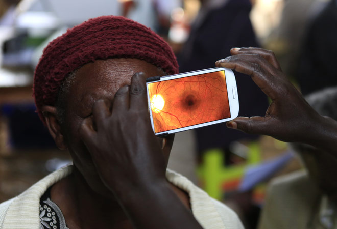 App detects eye disease using camera of the phone BusinessToday