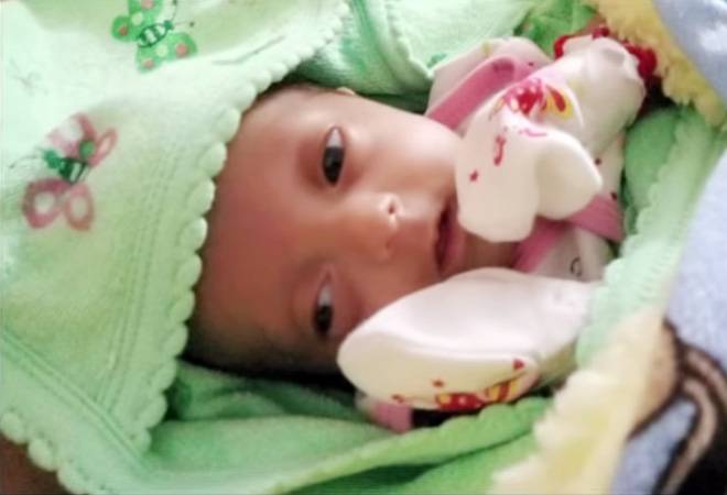 Cherry, the smallest baby in India who has beaten all the odds. Image: Rainbow Children's Hospital Cherry, the smallest baby in India who has beaten all the odds. Image: Rainbow Children's Hospital