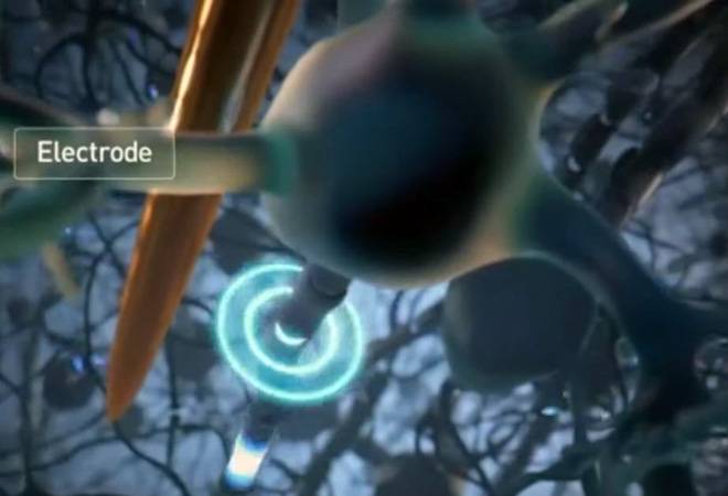 Elon Musk plans to link the brain with a computer Elon Musk plans to link the brain with a computer