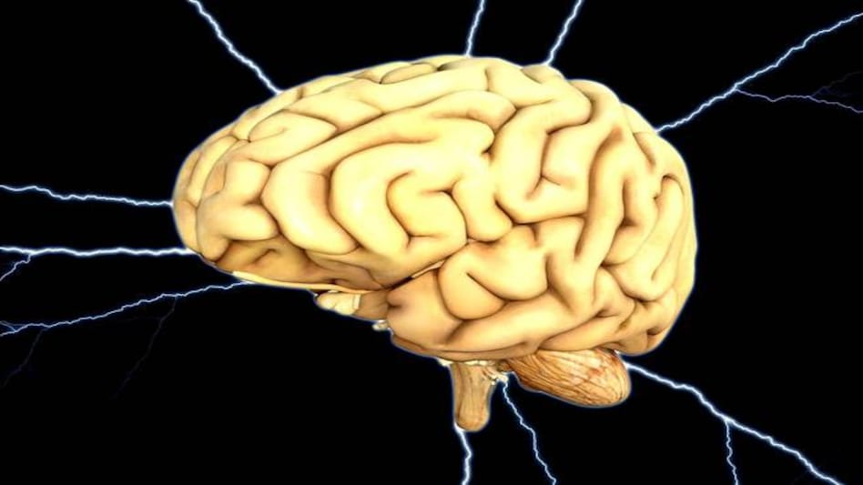 IIIT-Hyderabad researchers has created India-specific brain atlas. IIIT-Hyderabad researchers has created India-specific brain atlas.