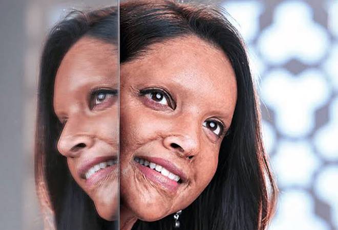 Chhapaak box office prediction: Chhapaak is bankrolled by both Deepika and Meghna in collaboration with Fox Star Studios Chhapaak box office prediction: Chhapaak is bankrolled by both Deepika and Meghna in collaboration with Fox Star Studios